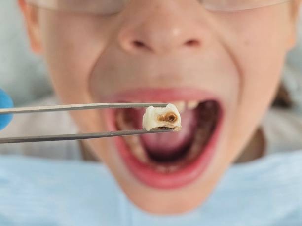 Best Holiday Emergency Dentist in Orange City, IA